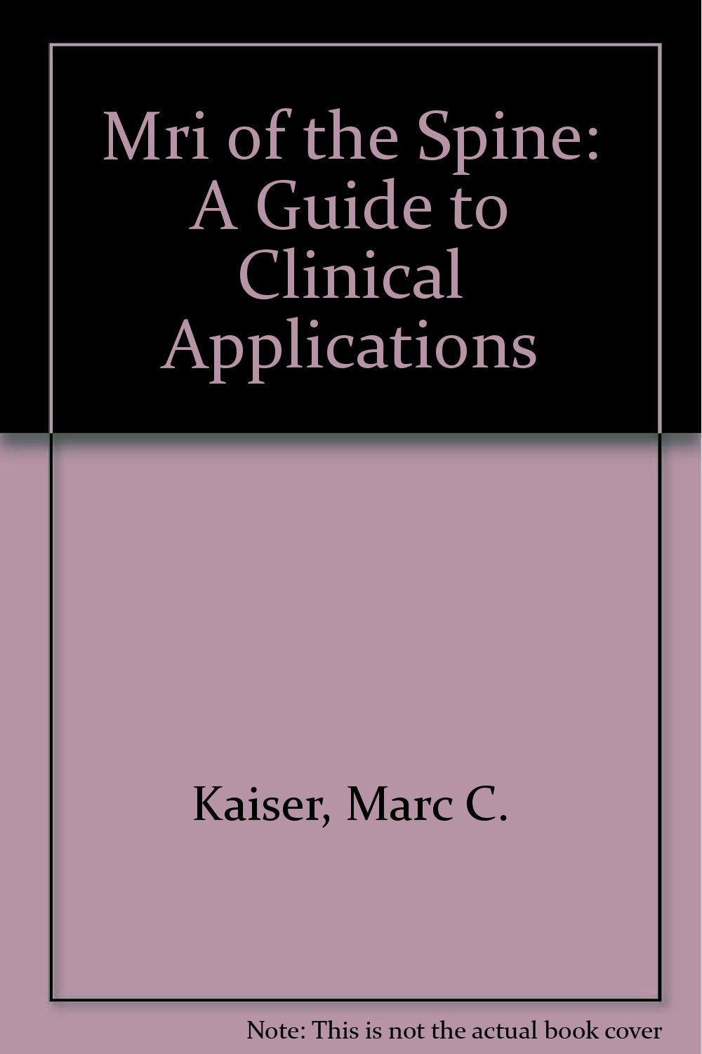 Mri of the Spine: A Guide to Clinical Applications